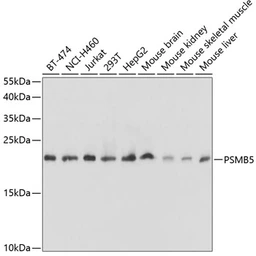 Anti-PSMB5 antibody used in Western Blot (WB). GTX55762