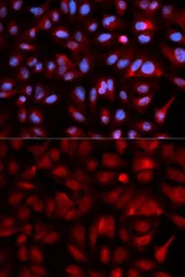 Anti-PSMB5 antibody used in Immunocytochemistry/ Immunofluorescence (ICC/IF). GTX55762