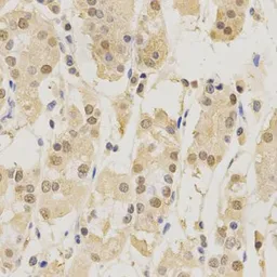 Anti-PSMB5 antibody used in IHC (Paraffin sections) (IHC-P). GTX55762