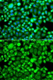 Anti-PSMB8 antibody used in Immunocytochemistry/ Immunofluorescence (ICC/IF). GTX55763