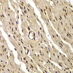 Anti-PSMB8 antibody used in IHC (Paraffin sections) (IHC-P). GTX55763
