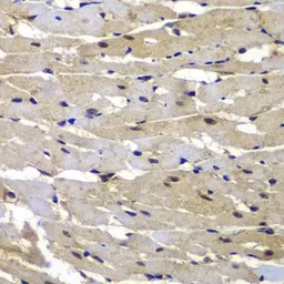 Anti-PSMB8 antibody used in IHC (Paraffin sections) (IHC-P). GTX55763
