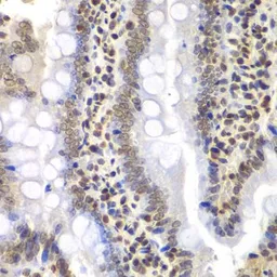 Anti-PSMC3 antibody used in IHC (Paraffin sections) (IHC-P). GTX55764