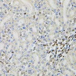 Anti-PSMC3 antibody used in IHC (Paraffin sections) (IHC-P). GTX55764