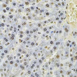 Anti-PSMC3 antibody used in IHC (Paraffin sections) (IHC-P). GTX55764
