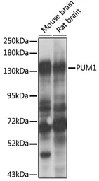 Anti-Pumilio 1 antibody used in Western Blot (WB). GTX55768