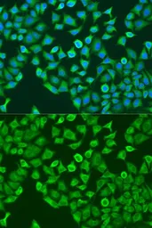 Anti-Pumilio 1 antibody used in Immunocytochemistry/ Immunofluorescence (ICC/IF). GTX55768