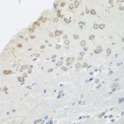 Anti-Pumilio 1 antibody used in IHC (Paraffin sections) (IHC-P). GTX55768