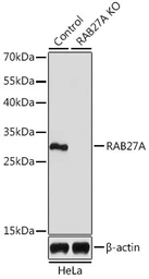 Anti-RAB27A antibody used in Western Blot (WB). GTX55770