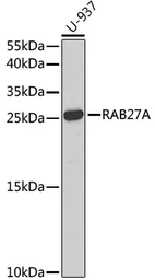 Anti-RAB27A antibody used in Western Blot (WB). GTX55770