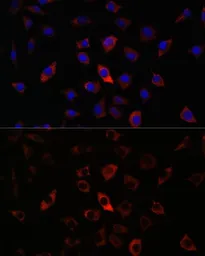 Anti-RAB27A antibody used in Immunocytochemistry/ Immunofluorescence (ICC/IF). GTX55770