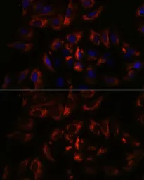 Anti-RAB27A antibody used in Immunocytochemistry/ Immunofluorescence (ICC/IF). GTX55770