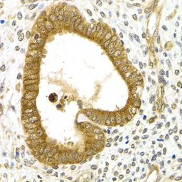 Anti-RAB27A antibody used in IHC (Paraffin sections) (IHC-P). GTX55770