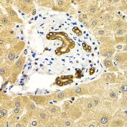 Anti-RAB27A antibody used in IHC (Paraffin sections) (IHC-P). GTX55770