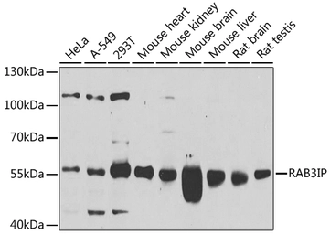 Anti-RAB3IP antibody used in Western Blot (WB). GTX55771