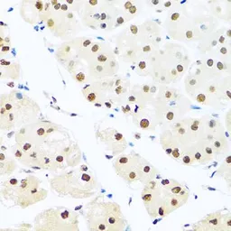 Anti-RAB3IP antibody used in IHC (Paraffin sections) (IHC-P). GTX55771