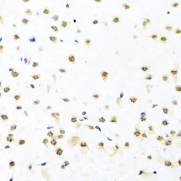 Anti-RAB3IP antibody used in IHC (Paraffin sections) (IHC-P). GTX55771