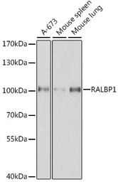 Anti-RALBP1 antibody used in Western Blot (WB). GTX55774
