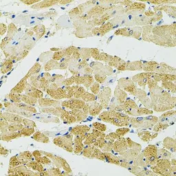 Anti-RALBP1 antibody used in IHC (Paraffin sections) (IHC-P). GTX55774