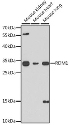 Anti-RDM1 antibody used in Western Blot (WB). GTX55776