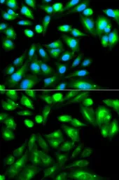 Anti-RhoC antibody used in Immunocytochemistry/ Immunofluorescence (ICC/IF). GTX55782