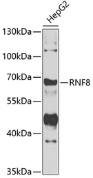 Anti-RNF8 antibody used in Western Blot (WB). GTX55783