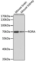 Anti-ROR alpha antibody used in Western Blot (WB). GTX55784