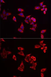Anti-RPL9 antibody used in Immunocytochemistry/ Immunofluorescence (ICC/IF). GTX55785