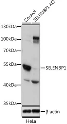 Anti-SELENBP1 antibody used in Western Blot (WB). GTX55788