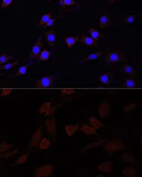 Anti-SERPINA10 antibody used in Immunocytochemistry/ Immunofluorescence (ICC/IF). GTX55791