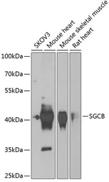 Anti-beta Sarcoglycan antibody used in Western Blot (WB). GTX55795