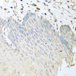 Anti-beta Sarcoglycan antibody used in IHC (Paraffin sections) (IHC-P). GTX55795