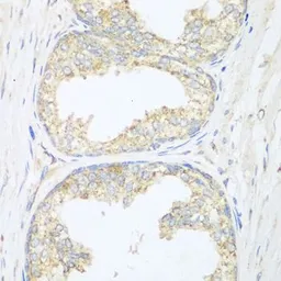 Anti-beta Sarcoglycan antibody used in IHC (Paraffin sections) (IHC-P). GTX55795