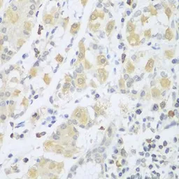 Anti-beta Sarcoglycan antibody used in IHC (Paraffin sections) (IHC-P). GTX55795
