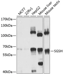 Anti-SGSH antibody used in Western Blot (WB). GTX55796