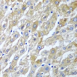 Anti-SGSH antibody used in IHC (Paraffin sections) (IHC-P). GTX55796