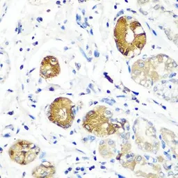 Anti-SGSH antibody used in IHC (Paraffin sections) (IHC-P). GTX55796