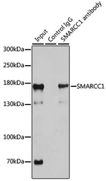 Anti-SMARCC1 antibody used in Immunoprecipitation (IP). GTX55802
