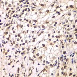Anti-SMARCC1 antibody used in IHC (Paraffin sections) (IHC-P). GTX55802