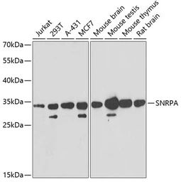 Anti-SNRPA antibody used in Western Blot (WB). GTX55804