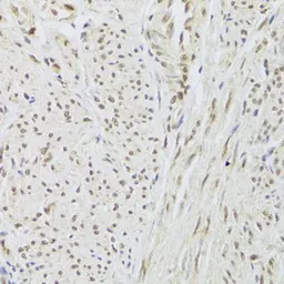 Anti-SNRPA antibody used in IHC (Paraffin sections) (IHC-P). GTX55804