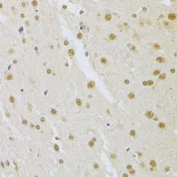 Anti-SNRPA antibody used in IHC (Paraffin sections) (IHC-P). GTX55804