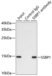 Anti-SSBP1 antibody used in Immunoprecipitation (IP). GTX55806