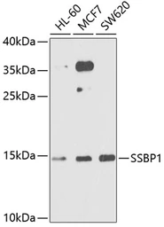 Anti-SSBP1 antibody used in Western Blot (WB). GTX55806