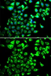 Anti-SSBP1 antibody used in Immunocytochemistry/ Immunofluorescence (ICC/IF). GTX55806