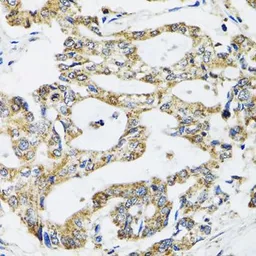 Anti-SSBP1 antibody used in IHC (Paraffin sections) (IHC-P). GTX55806