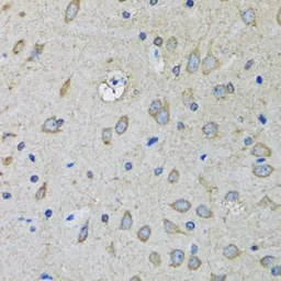 Anti-SSBP1 antibody used in IHC (Paraffin sections) (IHC-P). GTX55806