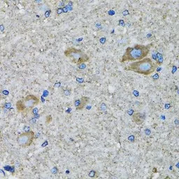 Anti-SSBP1 antibody used in IHC (Paraffin sections) (IHC-P). GTX55806