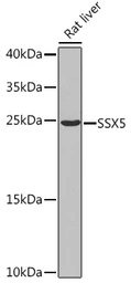 Anti-SSX5 antibody used in Western Blot (WB). GTX55807