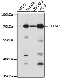 Anti-STAM2 antibody used in Western Blot (WB). GTX55808